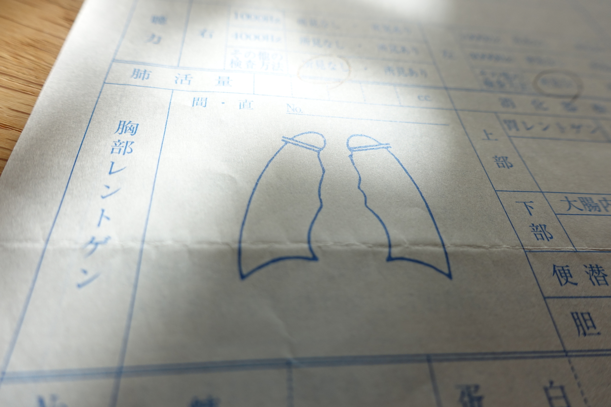マイコプラズマ肺炎とは?原因・症状・予防方法など紹介!
